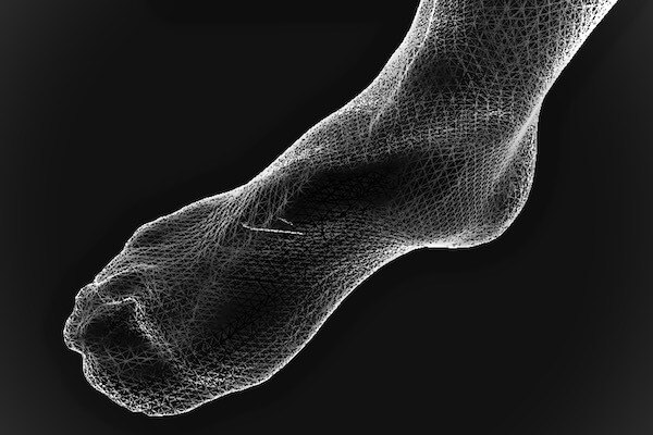 X-Ray, Orthotics, Foot